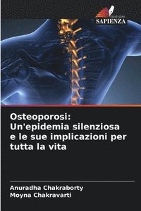 bokomslag Osteoporosi