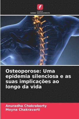 bokomslag Osteoporose: Uma epidemia silenciosa e as suas implicações ao longo da vida