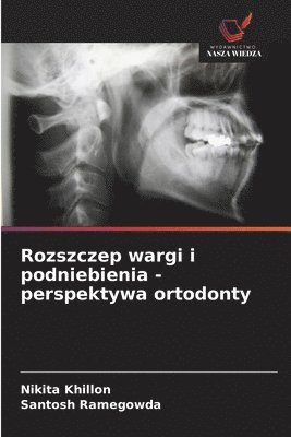 bokomslag Rozszczep wargi i podniebienia - perspektywa ortodonty