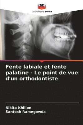 bokomslag Fente labiale et fente palatine - Le point de vue d'un orthodontiste