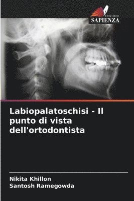 Nikita Khillon, Santosh Ramegowda - Labiopalatoschisi - Il punto di vista dell'ortodontista, Häftad