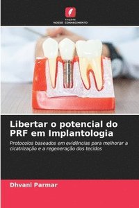 bokomslag Libertar o potencial do PRF em Implantologia