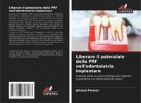 bokomslag Liberare il potenziale della PRF nell'odontoiatria implantare