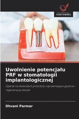 bokomslag Uwolnienie potencjalu PRF w stomatologii implantologicznej