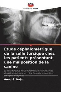 bokomslag Étude céphalométrique de la selle turcique chez les patients présentant une malposition de la canine