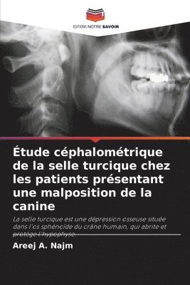 bokomslag Étude céphalométrique de la selle turcique chez les patients présentant une malposition de la canine