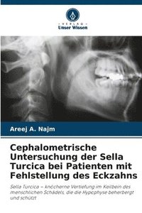 bokomslag Cephalometrische Untersuchung der Sella Turcica bei Patienten mit Fehlstellung des Eckzahns