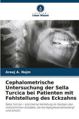 bokomslag Cephalometrische Untersuchung der Sella Turcica bei Patienten mit Fehlstellung des Eckzahns
