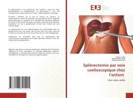 bokomslag Splénectomie par voie coelioscopique chez l'enfant
