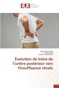 bokomslag Évolution de Valve de l'urètre postérieur vers l'insuffisance rénale