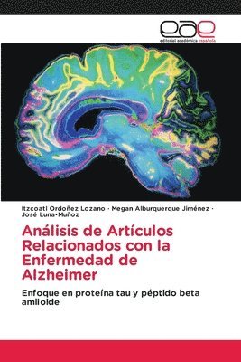 Análisis de Artículos Relacionados con la Enfermedad de Alzheimer