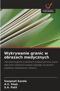 bokomslag Wykrywanie granic w obrazach medycznych