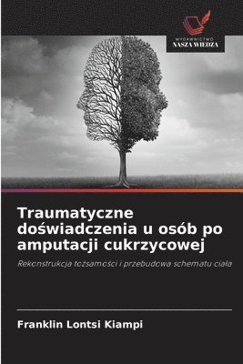 bokomslag Traumatyczne do?wiadczenia u osób po amputacji cukrzycowej