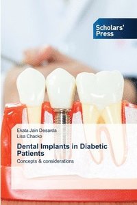 bokomslag Dental Implants in Diabetic Patients