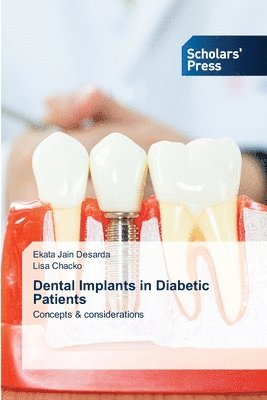 bokomslag Dental Implants in Diabetic Patients