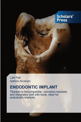 Lalit Patil, Sathish Abraham, SATHISH ABRAHAM - Endodontic Implant, Häftad