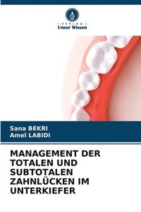 bokomslag Management Der Totalen Und Subtotalen Zahnlücken Im Unterkiefer