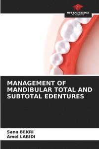 bokomslag Management of Mandibular Total and Subtotal Edentures
