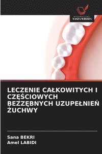 bokomslag Bekri, S: LECZENIE CA¿KOWITYCH I CZ¿¿CIOWYCH BEZZ¿BNYCH UZUP