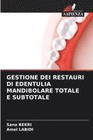 bokomslag Gestione Dei Restauri Di Edentulia Mandibolare Totale E Subtotale