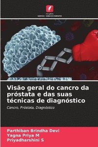 bokomslag Visão geral do cancro da próstata e das suas técnicas de diagnóstico