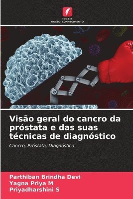 Parthiban Brindha Devi, Yagna Priya M, Priyadharshini S, Yagna Priya M. - Visão geral do cancro da próstata e das suas técnicas de diagnóstico, Häftad