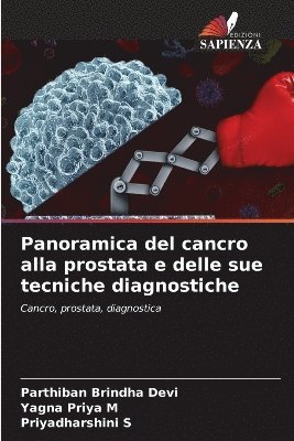 Parthiban Brindha Devi, Yagna Priya M, Priyadharshini S, Yagna Priya M. - Panoramica del cancro alla prostata e delle sue tecniche diagnostiche, Häftad