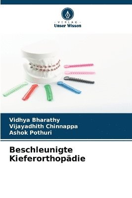 bokomslag Beschleunigte Kieferorthopädie