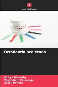bokomslag Ortodontia acelerada