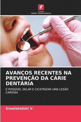 Avanços Recentes Na Prevenção Da Cárie Dentária