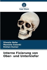 bokomslag Interne Fixierung von Ober- und Unterkiefer