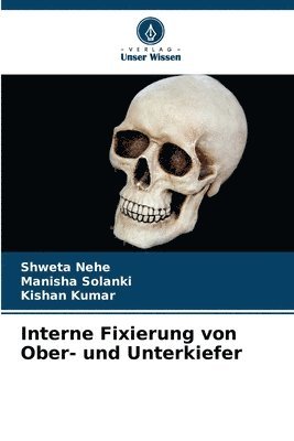 bokomslag Interne Fixierung von Ober- und Unterkiefer