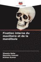 bokomslag Fixation interne du maxillaire et de la mandibule