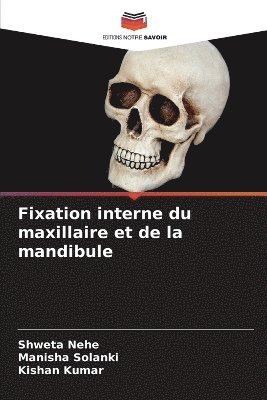 Fixation interne du maxillaire et de la mandibule