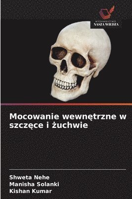 Mocowanie wewnętrzne w szczęce i żuchwie