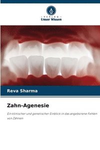 bokomslag Zahn-Agenesie