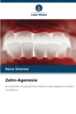 bokomslag Zahn-Agenesie