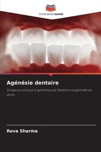 bokomslag Sharma, R: Agénésie dentaire