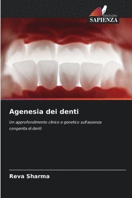 Agenesia dei denti