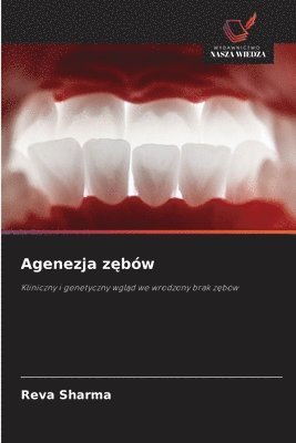 bokomslag Agenezja z?bów