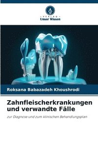 bokomslag Zahnfleischerkrankungen und verwandte Fälle