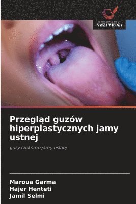 Maroua Garma, Hajer Henteti - Przegląd guzów hiperplastycznych jamy ustnej, Häftad