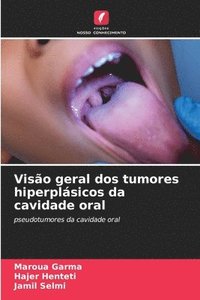 bokomslag Visão geral dos tumores hiperplásicos da cavidade oral