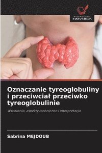 bokomslag Oznaczanie tyreoglobuliny i przeciwcial przeciwko tyreoglobulinie