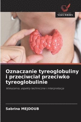 bokomslag Oznaczanie tyreoglobuliny i przeciwcial przeciwko tyreoglobulinie