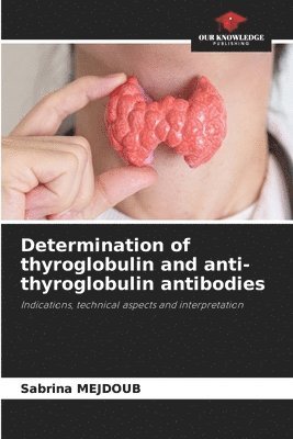 bokomslag Determination of thyroglobulin and anti-thyroglobulin antibodies