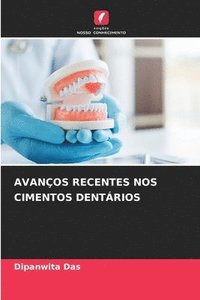 bokomslag AVANÇOS RECENTES NOS CIMENTOS DENTÁRIOS