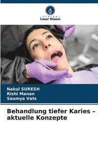bokomslag Behandlung tiefer Karies - aktuelle Konzepte