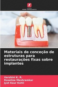 bokomslag Materiais de conceção de estruturas para restaurações fixas sobre implantes