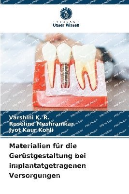 bokomslag Materialien für die Gerüstgestaltung bei implantatgetragenen Versorgungen